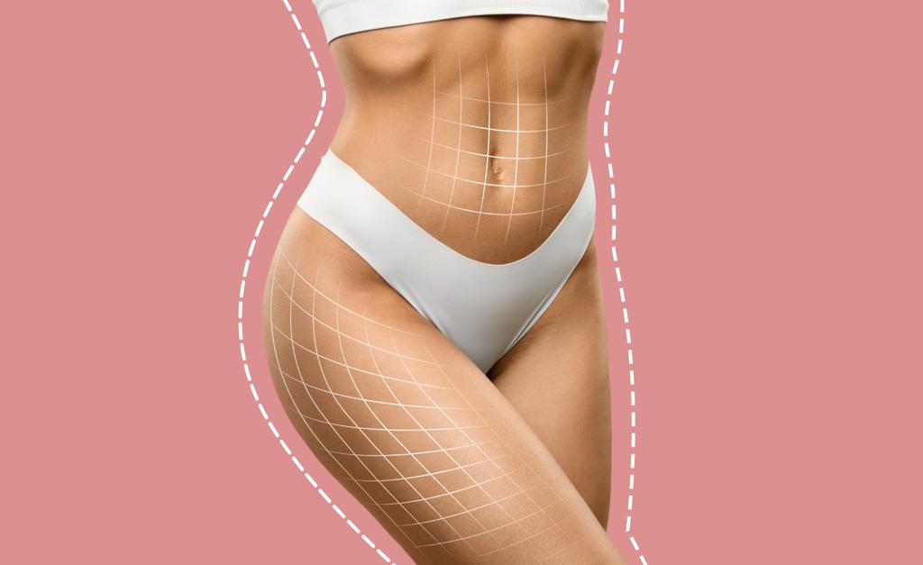 CoolSculpting VS body contouring